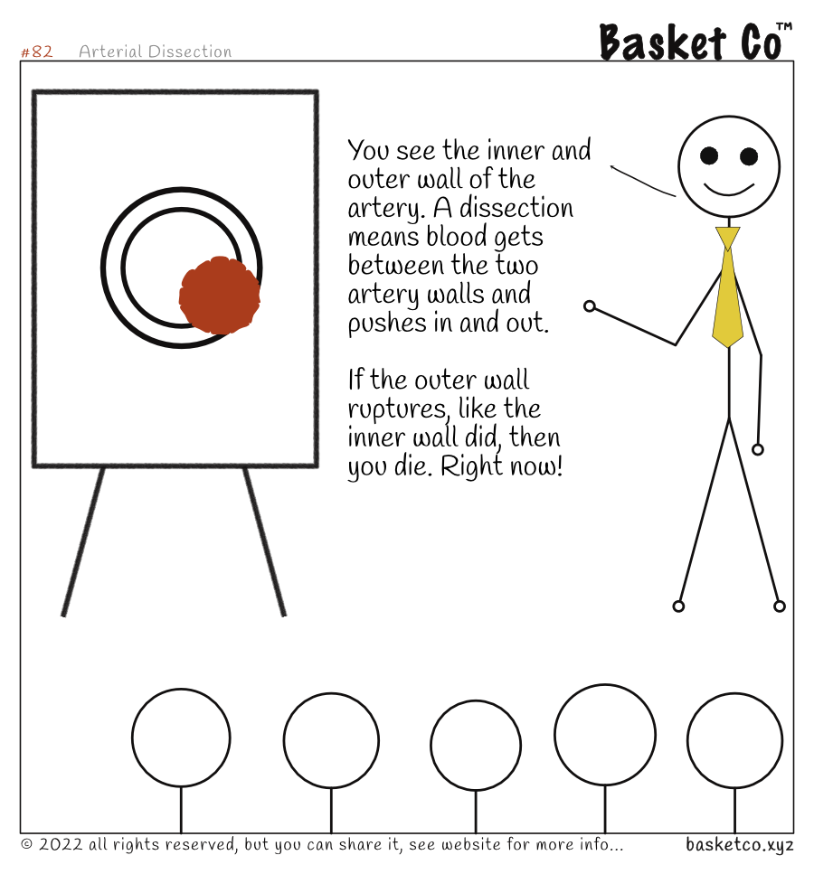 A employee giving a presentation. Shown on a flip-chart, The two walls of the artery, with blood bulging between the two. Dialog: What's wrong with your eye? I've got Horner's Syndrome. What causes it? One of four things, in order of severity: 1 - Bone spurs in the neck; 2 - Tumour in lung or brain; 3 - Cancer in lung or brain; 4 - Arterial dissection